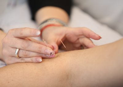 Acupuncture for elbow, hand and wrist injuries at Body Works Leicester